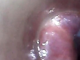 Endoscope POV Test Tube Cock Urethral Insertion
